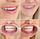 Slider image (9) Astra Dental Clinic
